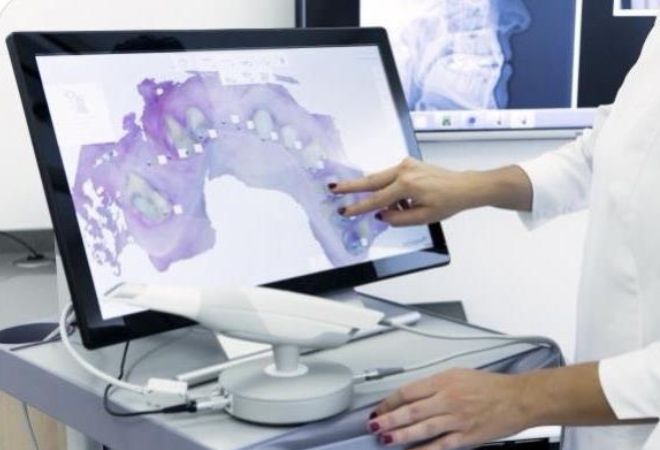3D ψηφιακό μοντέλο δοντιών στην οθόνη